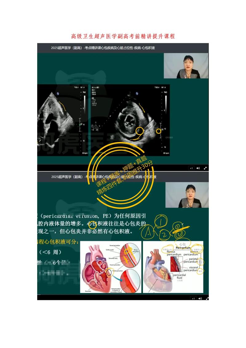 超声医学副高考试大纲_往年超声医学技术卫生副高级职称考试模拟试题_超声医师副高考试题库